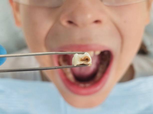 Best Emergency Dental Services for Seniors in South Paris, ME